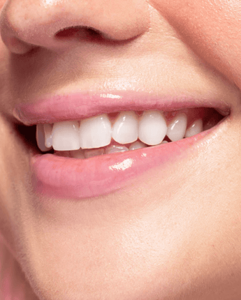 Masque lèvres Fruit du dragon - Bébé LoupAvatara